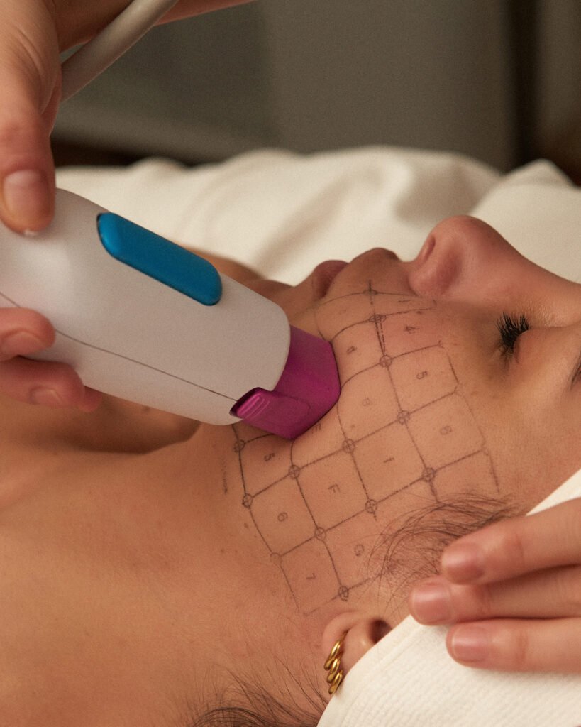 Thermage FLX