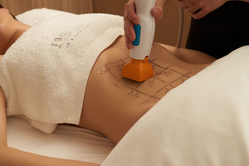 Thermage FLX Body